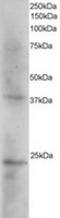 SET Nuclear Proto-Oncogene antibody, TA302603, Origene, Western Blot image 