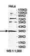 DNA Polymerase Beta antibody, orb78423, Biorbyt, Western Blot image 
