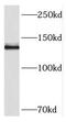 Protocadherin 11 X-Linked antibody, FNab06195, FineTest, Western Blot image 