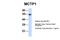 Multiple C2 And Transmembrane Domain Containing 1 antibody, NBP1-59908, Novus Biologicals, Western Blot image 