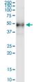 Desert hedgehog protein antibody, H00050846-M01, Novus Biologicals, Western Blot image 