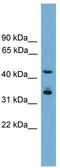 Homeobox protein GBX-1 antibody, TA342313, Origene, Western Blot image 
