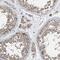 Kinetochore-associated protein 1 antibody, HPA025241, Atlas Antibodies, Immunohistochemistry frozen image 