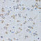 Arginyl-TRNA Synthetase antibody, LS-C334629, Lifespan Biosciences, Immunohistochemistry paraffin image 