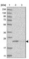 Coiled-Coil Domain Containing 190 antibody, NBP1-82672, Novus Biologicals, Western Blot image 