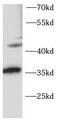 Homeobox protein OTX2 antibody, FNab10083, FineTest, Western Blot image 