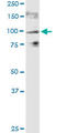 Transient Receptor Potential Cation Channel Subfamily V Member 1 antibody, LS-C139103, Lifespan Biosciences, Western Blot image 