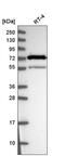 PAB1 antibody, HPA045423, Atlas Antibodies, Western Blot image 