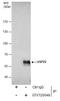 Ubiquitin carboxyl-terminal hydrolase 22 antibody, GTX120048, GeneTex, Immunoprecipitation image 