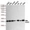 Growth Factor Receptor Bound Protein 2 antibody, TA346955, Origene, Western Blot image 