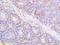 Metallothionein-1 antibody, A30377, Boster Biological Technology, Immunohistochemistry paraffin image 
