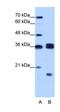 Heterogeneous Nuclear Ribonucleoprotein H3 antibody, orb324892, Biorbyt, Western Blot image 