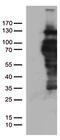 Progesterone Receptor antibody, CF805280, Origene, Western Blot image 