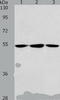 Aldehyde Dehydrogenase 9 Family Member A1 antibody, TA323584, Origene, Western Blot image 
