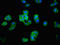 Adhesion G Protein-Coupled Receptor B2 antibody, LS-C671447, Lifespan Biosciences, Immunofluorescence image 