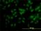 Putative SCAN domain-containing protein 2 antibody, H00054581-M01, Novus Biologicals, Immunofluorescence image 