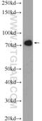 Cytoskeleton-associated protein 2 antibody, 25486-1-AP, Proteintech Group, Western Blot image 