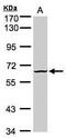 Dual Specificity Tyrosine Phosphorylation Regulated Kinase 3 antibody, PA5-21875, Invitrogen Antibodies, Western Blot image 