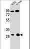 Electron transfer flavoprotein subunit alpha, mitochondrial antibody, LS-B9584, Lifespan Biosciences, Western Blot image 