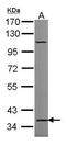 Zinc finger protein RFP antibody, PA5-27619, Invitrogen Antibodies, Western Blot image 