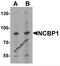 Nuclear Cap Binding Protein Subunit 1 antibody, 7395, ProSci Inc, Western Blot image 