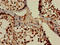 hPot1 antibody, LS-C679099, Lifespan Biosciences, Immunohistochemistry paraffin image 