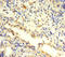 Proteasome 26S Subunit, ATPase 3 antibody, A63246-100, Epigentek, Immunohistochemistry paraffin image 