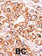 Phosphoinositide Kinase, FYVE-Type Zinc Finger Containing antibody, 62-704, ProSci, Immunohistochemistry paraffin image 