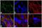 Retinoic Acid Receptor Alpha antibody, PA1-810A, Invitrogen Antibodies, Immunofluorescence image 