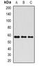 Alkaline Phosphatase, Placental antibody, abx225027, Abbexa, Western Blot image 