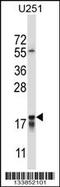 Autoimmunogenic cancer/testis antigen NY-ESO-2 antibody, 57-255, ProSci, Western Blot image 