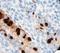 Adenovirus antibody, LS-C311932, Lifespan Biosciences, Immunohistochemistry frozen image 