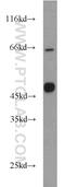 MAGE Family Member A8 antibody, 15045-1-AP, Proteintech Group, Western Blot image 