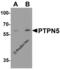 Protein Tyrosine Phosphatase Non-Receptor Type 5 antibody, 8013, ProSci, Western Blot image 
