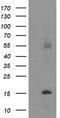 Transmembrane Protein 230 antibody, TA504942AM, Origene, Western Blot image 