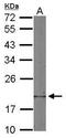 Destrin antibody, PA5-29933, Invitrogen Antibodies, Western Blot image 