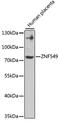 Zinc Finger Protein 549 antibody, 22-919, ProSci, Western Blot image 