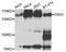 Desmoglein 1 antibody, A9812, ABclonal Technology, Western Blot image 