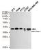 Protein Kinase AMP-Activated Non-Catalytic Subunit Beta 1 antibody, GTX66847, GeneTex, Western Blot image 