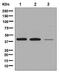 LTB4 antibody, ab131041, Abcam, Western Blot image 