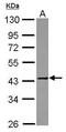 Matrix Metallopeptidase 23B antibody, PA5-30726, Invitrogen Antibodies, Western Blot image 