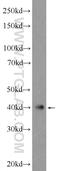 Ataxin 3 Like antibody, 25099-1-AP, Proteintech Group, Western Blot image 