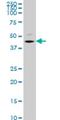 Serine/Threonine Kinase 32C antibody, H00282974-M08, Novus Biologicals, Western Blot image 