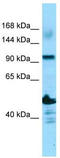 ADAM Metallopeptidase With Thrombospondin Type 1 Motif 14 antibody, TA337908, Origene, Western Blot image 