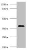 Galactose-1-phosphate uridylyltransferase antibody, A54772-100, Epigentek, Western Blot image 