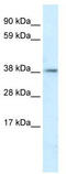 Proteasome 26S Subunit, Non-ATPase 11 antibody, TA332117, Origene, Western Blot image 
