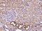 ADP-ribosylation factor-like protein 6 antibody, 200421-T08, Sino Biological, Immunohistochemistry paraffin image 