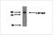 Cytochrome P450 Family 4 Subfamily V Member 2 antibody, TA353139L, Origene, Western Blot image 