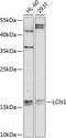LCN1 antibody, 23-928, ProSci, Western Blot image 