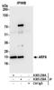 ADP Ribosylation Factor 6 antibody, A305-239A, Bethyl Labs, Immunoprecipitation image 